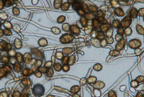 Sphaeropsidales -homesienen kasvustoa mikroskoopissa